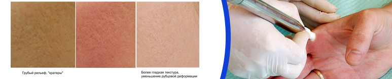 Дерматология